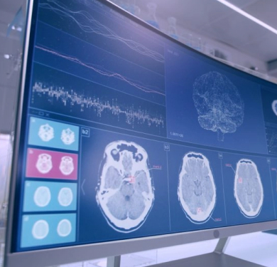 Biotrial preclinical Eeg Signal