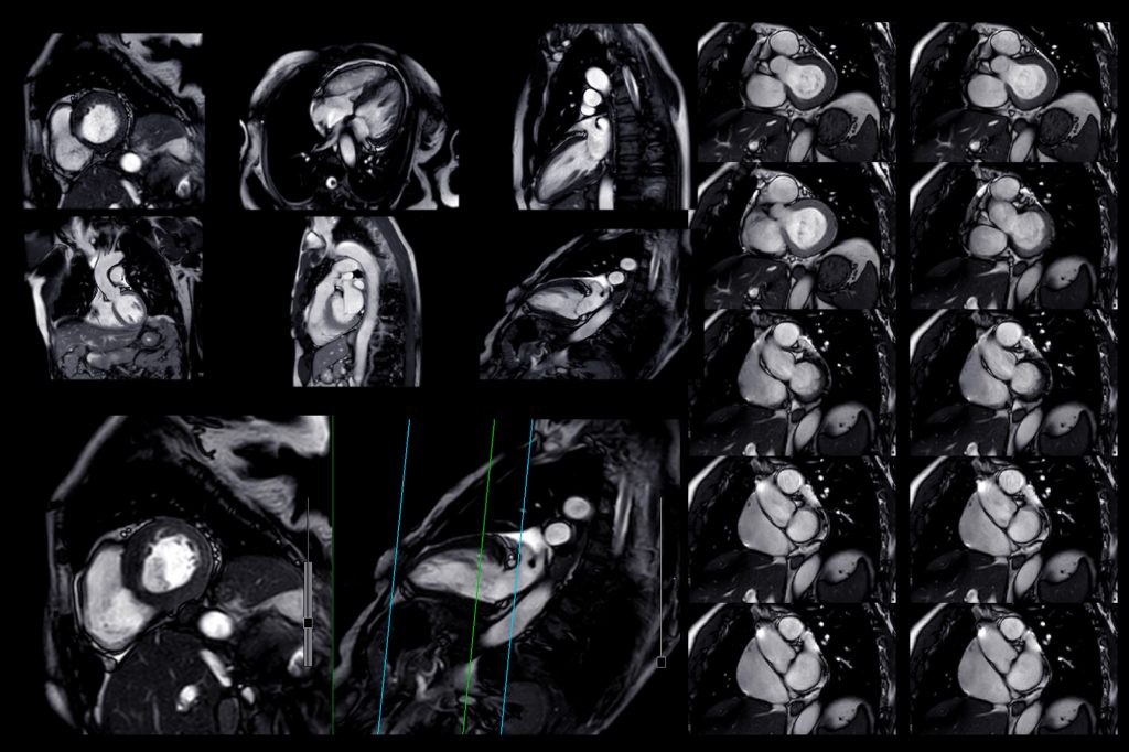 Biotrial-Corelab-Cardiac-Imaging