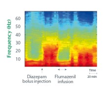 Biotrial-Core-Lab-Qeeg