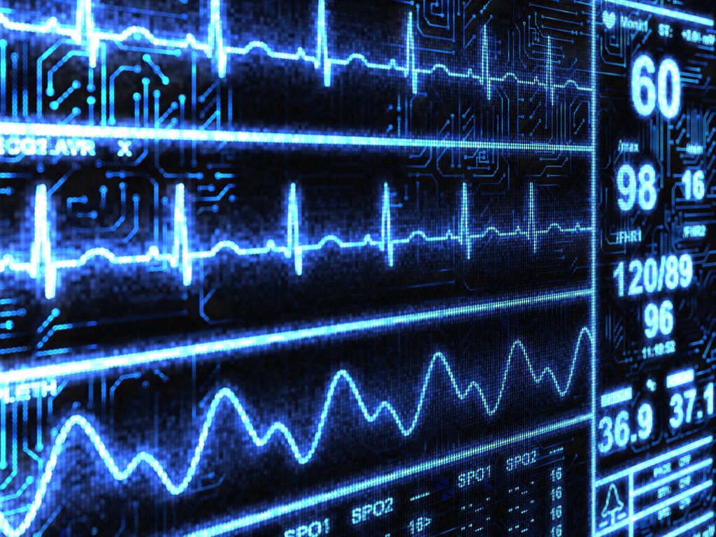 Biotrial-preclinical-Eeg-Signals