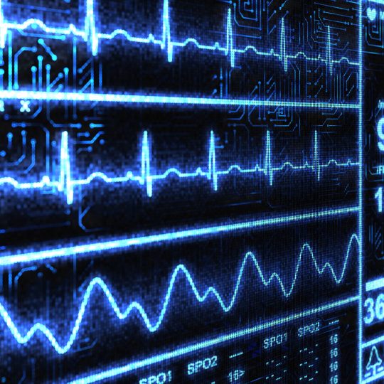 Biotrial-preclinical-Eeg-Signals