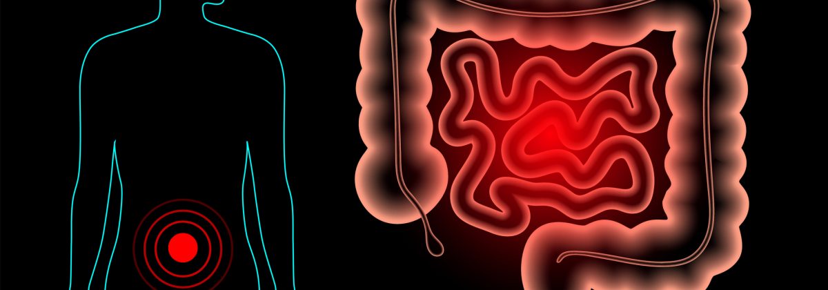 Biotrial-Intestine-Pain-Concept