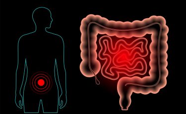 Biotrial-Intestine-Pain-Concept