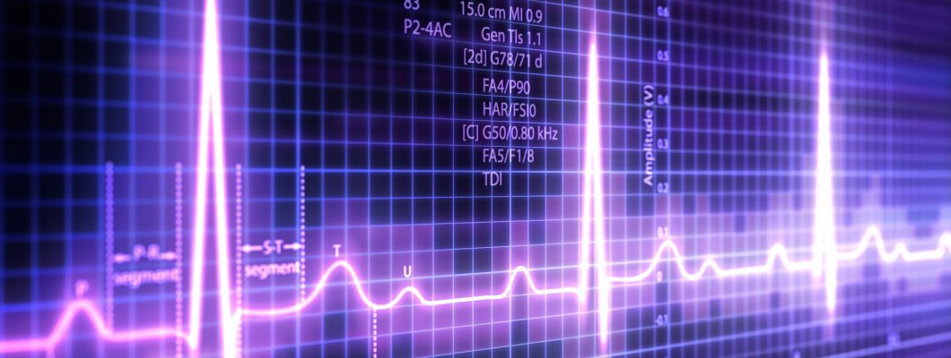 Biotrial Therapeutic Area Cardiology Scaled