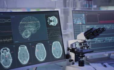 neuropsychiatric disorders_preclinical_studies_biotrial
